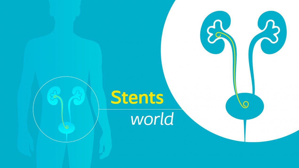 Stent-endo-Urology